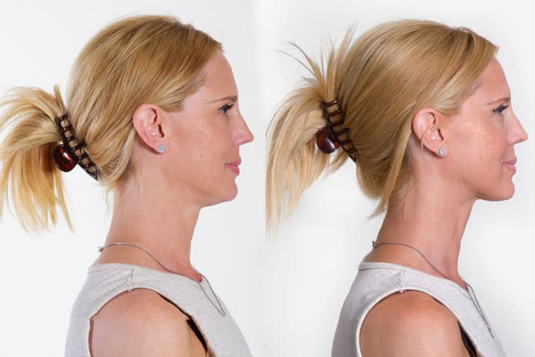 My Face Lift: Il massaggiatore per collo e mento che aiuta a ridurre la dimensione del doppio mento